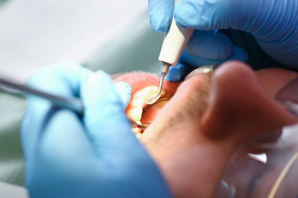 Best Emergency Broken Tooth Repair in Edgefield, SC