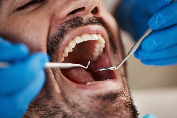 Best Pediatric Emergency Dentist in Edgefield, SC